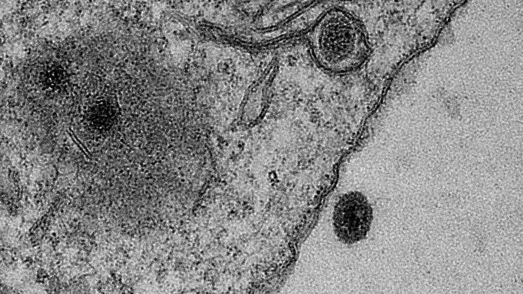 科学家揭示神秘物质未来之星的惊人发现